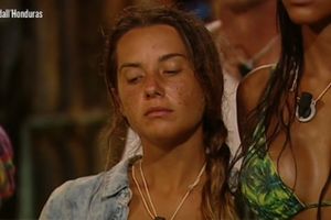 Melissa P e l'acne sull'Isola dei Famosi