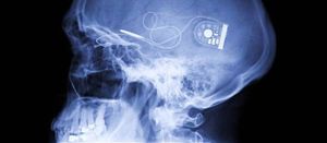 10 technologies qui pourraient réduire l’espèce humaine en esclavage