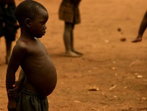 Autoriser le riz doré aiderait à lutter contre la malnutrition