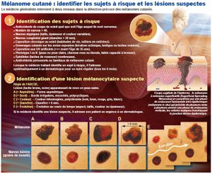 Mélanome cutané : la détection précoce est essentielle