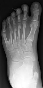 La survie, c'est le pied !