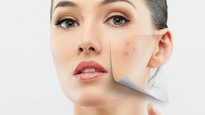 Peau, soins, conseilles,