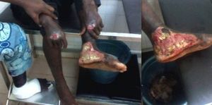 ZAKRA DAKOURI ERNEST, chauffeur de SIMONE GBAGBO torturé à la MACA (Le Gri-Gri)