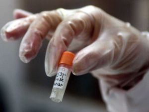 Ebola: le sérum expérimental déclenche une polémique éthique (AFP)