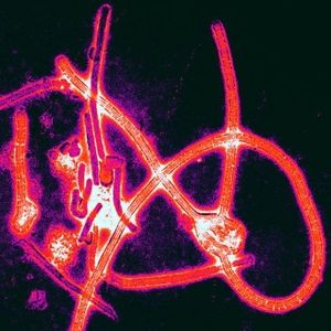 Un mal mystérieux frappe les survivants d'Ebola (Journal de la Science)