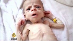Selon le P.A.M des millions de Yéménites souffrent de famine alors que la guerre fait rage