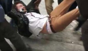 Le jeune homme blessé dans une manifestation contre la « loi travail » toujours dans un état grave (Le Monde)