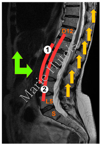 Allumer la voix : 1. le rôle du muscle psoas