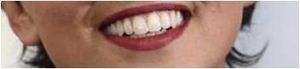 L'école... et la "stratégie Colgate"