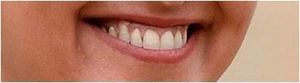 L'école... et la "stratégie Colgate"