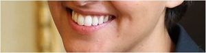 L'école... et la "stratégie Colgate"
