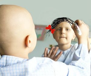 Des copines unies contre le cancer