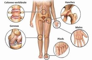 Conseil du jour : Douleurs articulaires