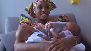 rfi - Deux enfants siamois guinéens de 5 mois séparés à Necker