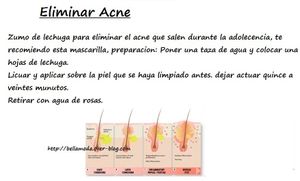 Eliminar Acne