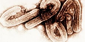 L’Ebola qu’est-ce que c’est ?