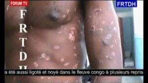 ©Une victime de torture sur FRTDH