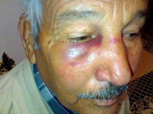 Laghouat : Jusqu’où ira la sauvagerie des agents de l’ordre ?