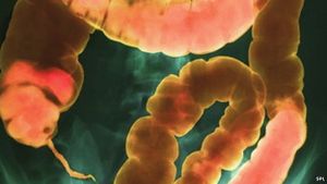 Come informarsi sul nostro microbioma intestinale