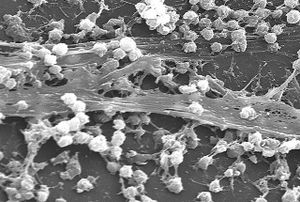 un biofilm batterico
