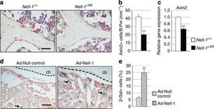 Le grandi opportunità che offrirà la proteina NELL-1