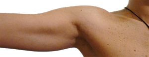 Astuces pour enlever les taches dans le corps
