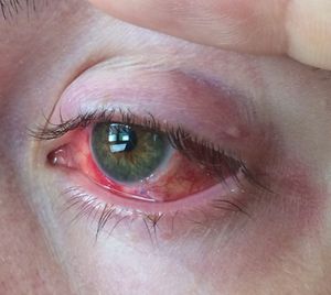 Joyeux alimentation cancer chimiothérapie game