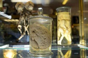 Hors Série : Le Musée Dupuytren