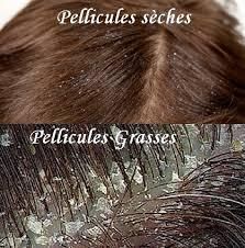masque pour cheveux anti pelliculaire masque pour cheveux anti pelliculaire
