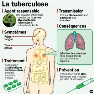 Un cas de tuberculose à l’école Nonneville d’Aulnay-sous-Bois