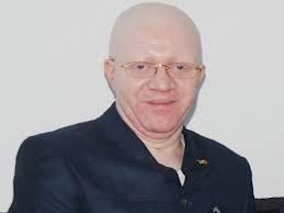 Quand le ministre albinos se défend