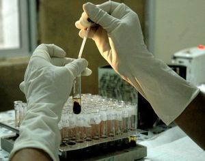 Chronique de Meurdé : mon mec à le syphilis, j'ai fait le test VIH, j'ai peur