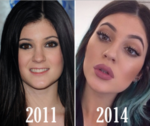 L'évolution physique de Kylie