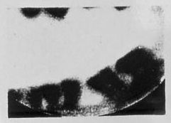 première radiographie dentaire (Walkhoof)