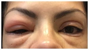 APRÈS LA LECTURE DE CE QUE VOUS NE SEREZ JAMAIS UTILISER DE FAUX CILS ... INCROYABLE!