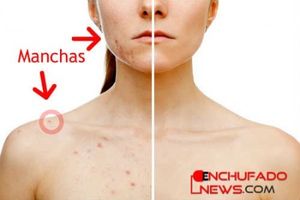 Savez-vous comment faire pour supprimer les taches sur la peau? Je vous assure que vous allez adorer