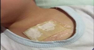 Ginger Wrap - Supprime Mucus de Poumons et Cures Coughs forts pour une seule nuit! Très efficace pour les enfants