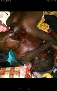Ici des victimes des milices pro ouattara appeles microbes