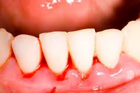 Tips For Getting A Brighter And Whiter Smile