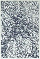 Sleeve et Fibroscopie 1