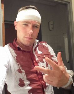 Le chanteur Goldofaf agressé à coups de marteau par 5 racailles d'extrême-gauche