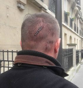 Communiqué de Goldofaf suite à sa violente agression par 5 antifas
