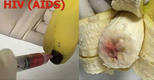 Il Injecte le Virus du Sida dans des Bananes (Vidéo)