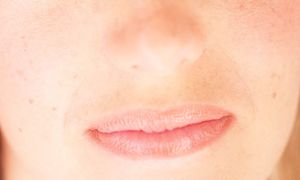 Soins de la peau naturel