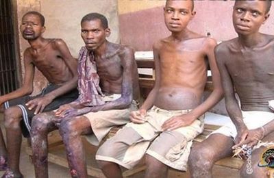 Côte d'Ivoire. Les corps décharnés des prisonniers politiques (AFPA)