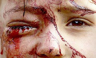 U.S.-U.K. Genocide Against Iraq 1990-2012 Killed 3.3 Millions