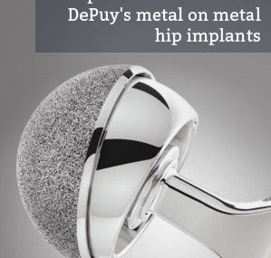 Hip Implant Issues Talked About by Specialists