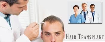 hair transplantation in Hyderabad:
It used to be we take plugs from the back