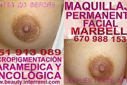 MICROPIGMENTACIÓN MÉDICA , DERMOPIGMENTACION CICATRICES