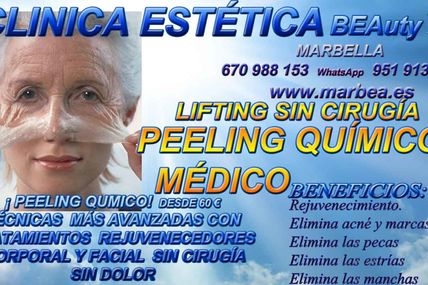 PEELING EN MARBELLA FACIAL QUÍMICO MÉDICO EN MARBELLA PARA SOLUCIÓN CONTRA EL : PECAS -
